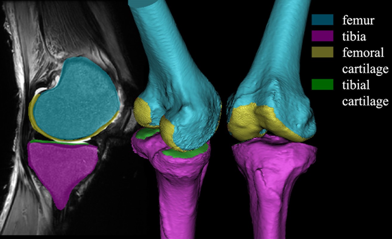 knee_cartilage.jpg